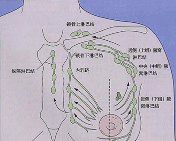 腋窝淋巴结分组示意图图片