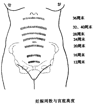 妊娠宫底高度图图片