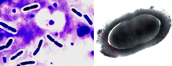 肺炎双球菌夹馍图片