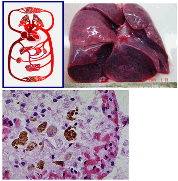 慢性肺淤血大体标本图片