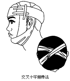 十字交叉绑扎法图片