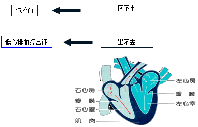 肺动脉瓣区第二心音亢进对诊断慢性左心衰最有价值的表现是e西地兰d