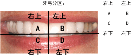 牙位记录法部位图片